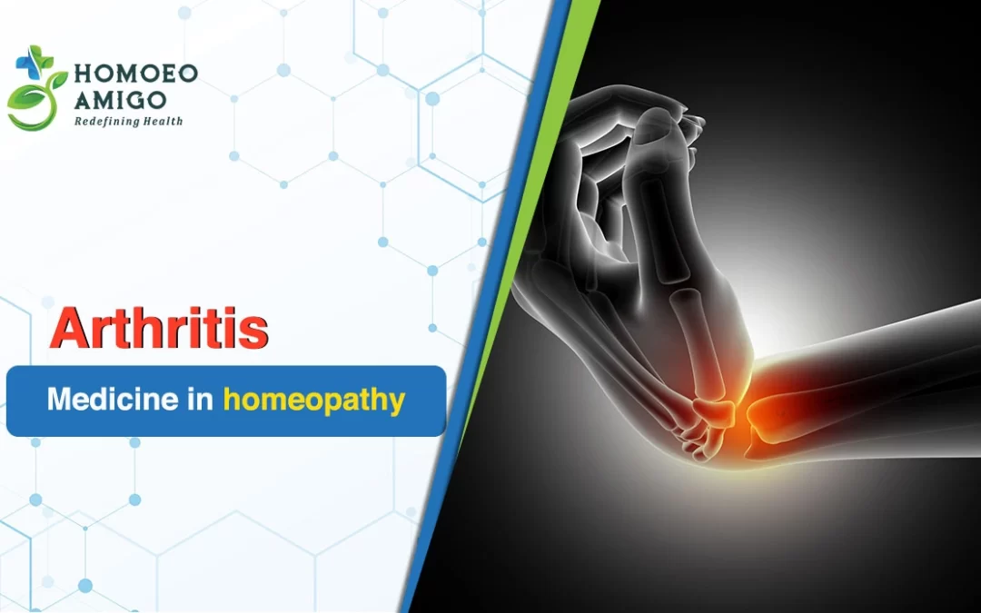Exploring Holistic Wellness with Arthritis Medicine in Homeopathy