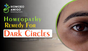 Homeopathic Remedy For Dark Circles to Enhance Your Glow