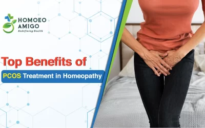 Top Benefits of PCOS Treatment in Homeopathy