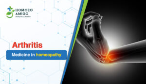 Exploring Holistic Wellness with Arthritis Medicine in Homeopathy