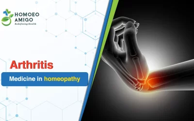 Exploring Holistic Wellness with Arthritis Medicine in Homeopathy