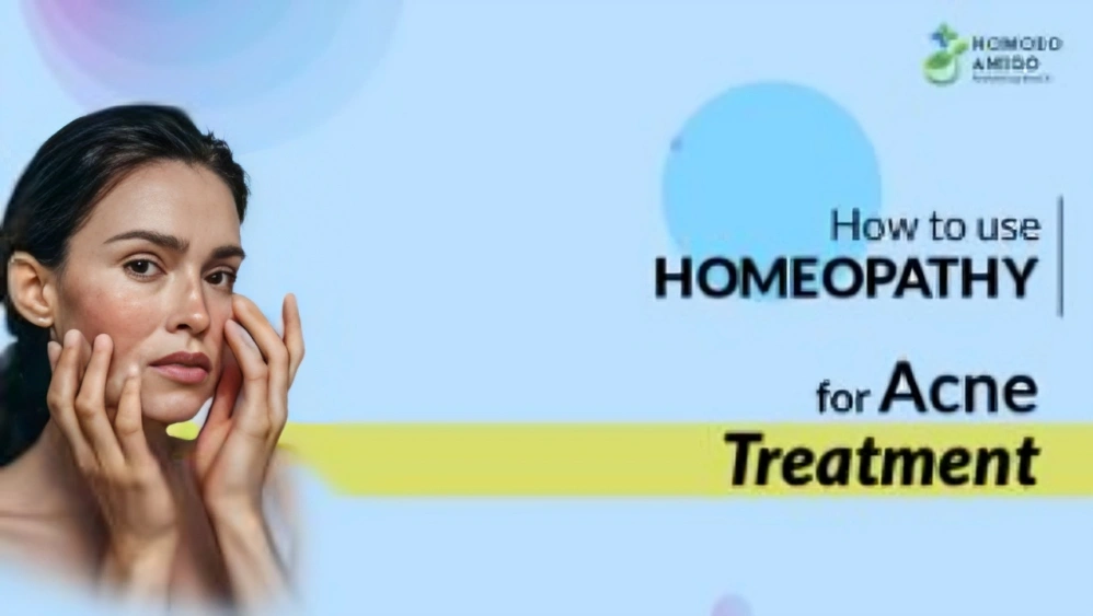 Acne Homeopathic Treatment